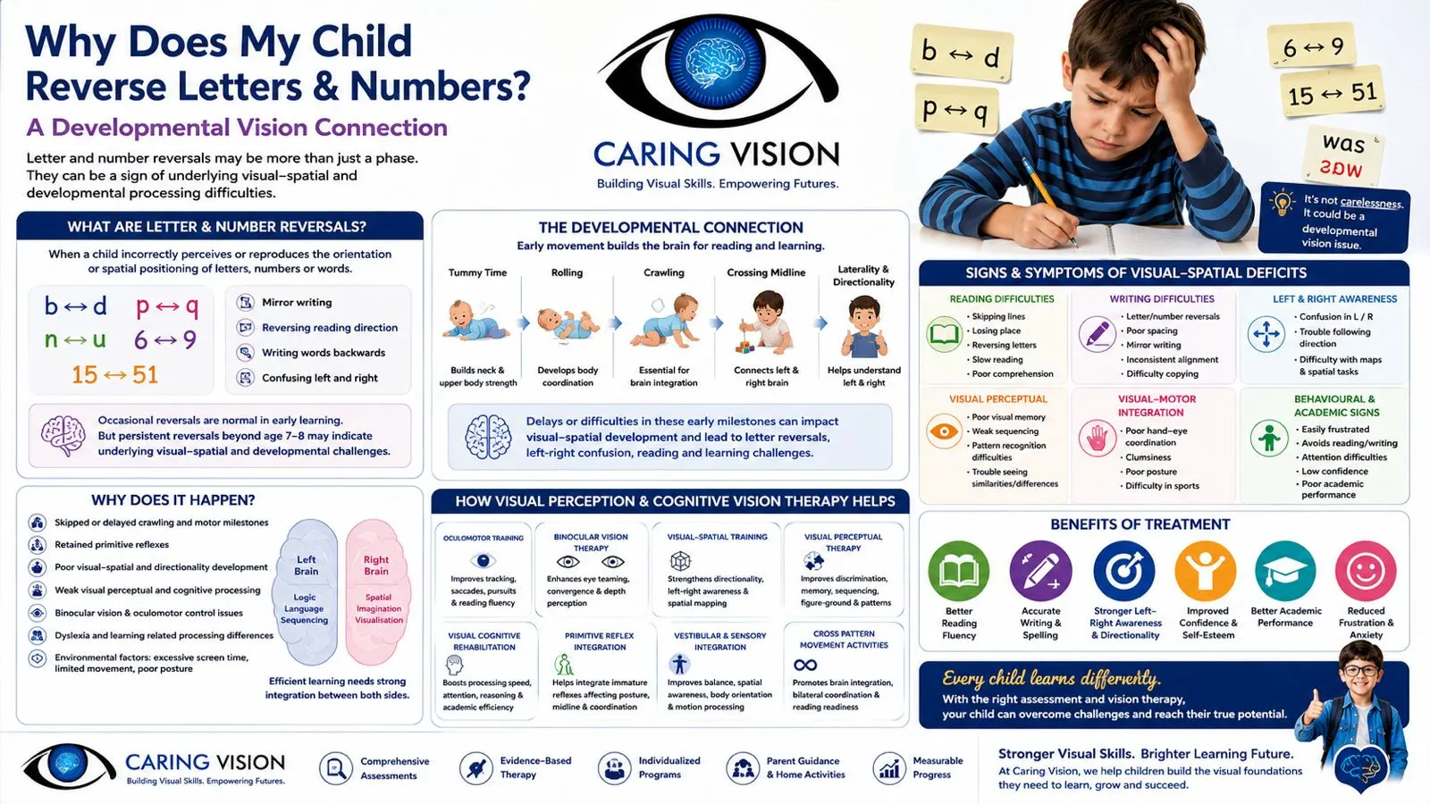 Child reversing letters during reading and writing due to developmental vision difficulties