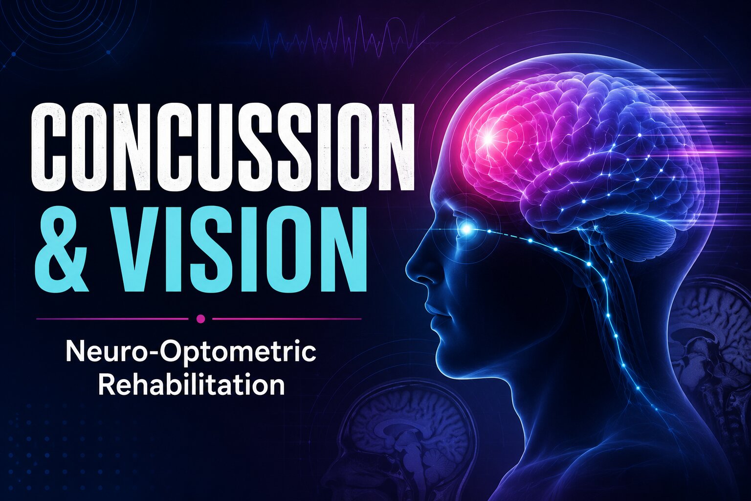 Concussion and Concussion-Related Visual Disturbances: The Critical Role of Neuro-Optometric Rehabilitation