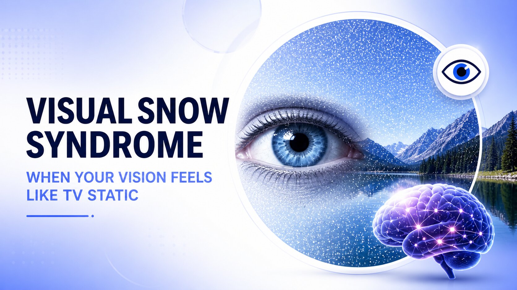 Neuro Optometric Rehabilitation Therapy (NORT) for Visual Snow Syndrome