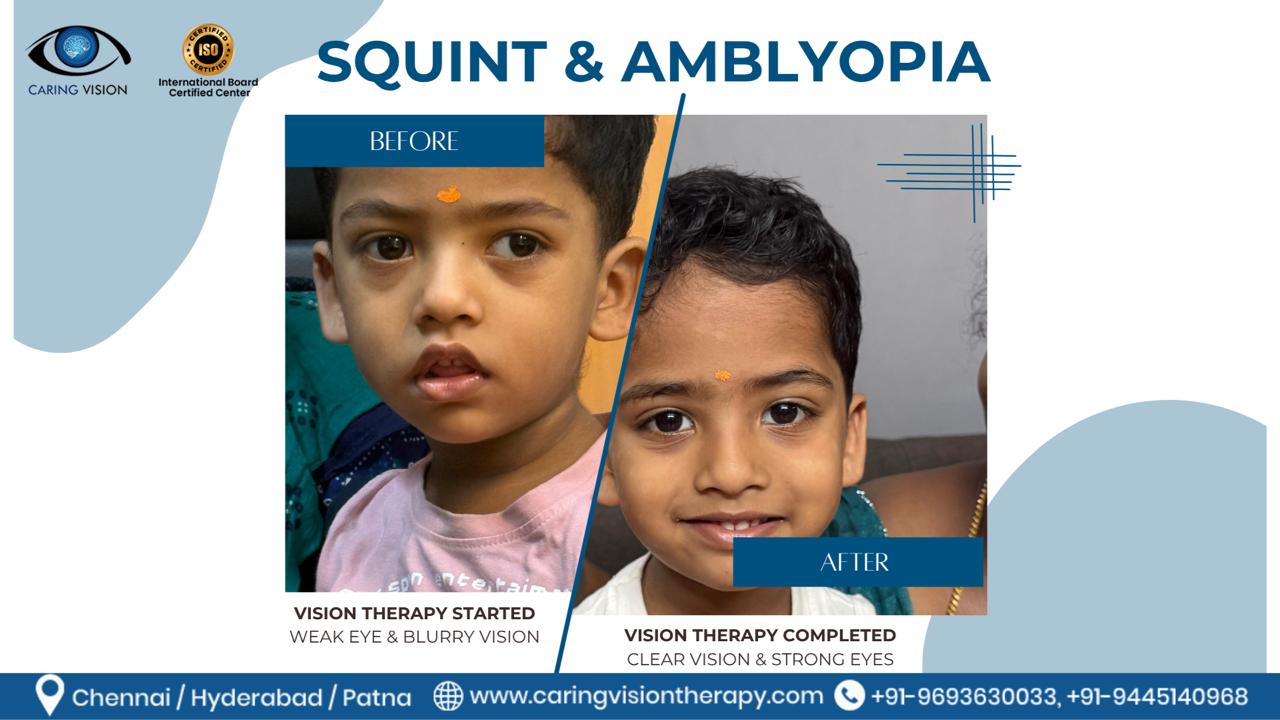 Parent sharing their child's squint and amblyopia treatment outcome at Caring Vision Therapy